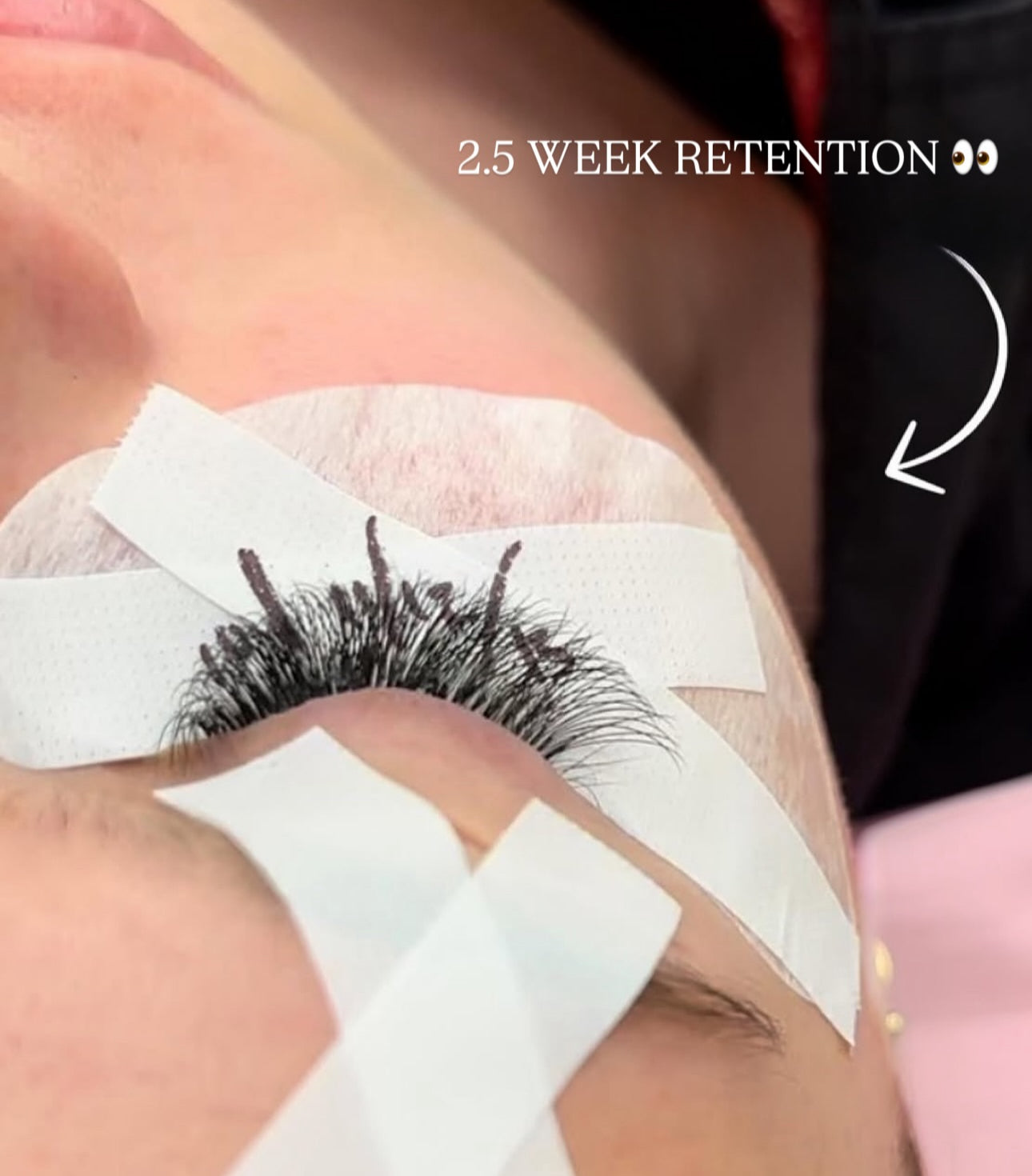 Eyelash extensions with adhesive tape on a person's eyelid, labeled '2.5 Week Retention'.